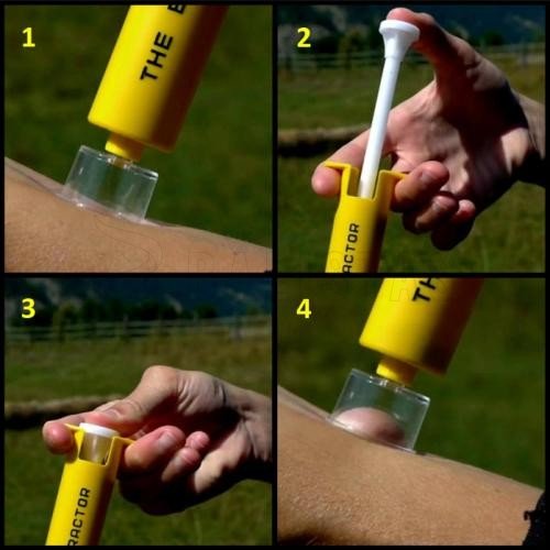 Set tegen beten Sawyer Bite & Sting Kit